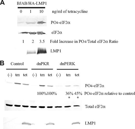 Figure 1. Expression of dominant-negative PERK, but not dominant-negative PKR, inhibits phosphorylation of eIF2α induced by LMP1 expression. (A) The EBV-negative B cell, BJAB, constructed to express LMP1 inducible by tetracycline, BJAB/HA-LMP1, was untreated or treated with 1 ng/mL or 10 ng/mL tetracycline for 48 hours. The cells were harvested and analyzed by Western blotting using anti–phosphorylated eIF2α, anti–total eIF2α, and anti-LMP1 antibodies. (B) BJAB/HA-LMP1 cells were infected with a control retrovirus and either dominant-negative PERK or dominant-negative PKR. After 48 hours of infection, the cells were sorted for the highest levels of expression of GFP encoded by the retroviruses. Each population was either left untreated, treated with 10 ng/mL tetracycline for 48 hours to induce LMP1, or treated with 2.5 μg/mL tunicamycin for 4 hours to activate PERK. The cells were harvested and analyzed as described in panel A. The ratios of phosphorylated eIF2α to total eIF2α were calculated. The numbers represent the percentage of phosphorylation of eIF2α relative to cells infected with control retrovirus. *P (2-sided) <.05, Wilcoxon signed rank test. A representative example of 4 independent experiments is shown.