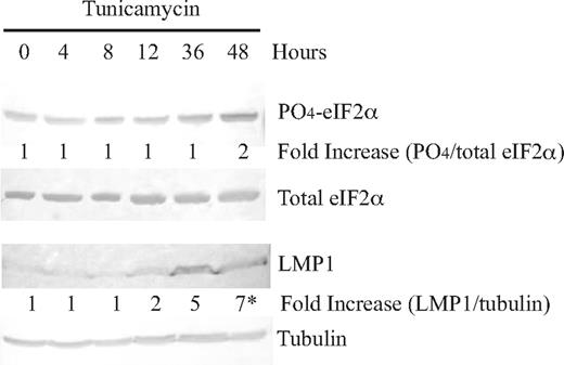 Figure 5. Induction of phosphorylation of eIF2α with tunicamycin in an EBV-positive cell line, 721, leads to an increase in LMP1 protein levels. Cells of an EBV-positive cell line, 721, were treated with 2.5 μg/mL tunicamycin, harvested at 0, 4, 8, 12, 36, and 48 hours, and analyzed by Western blotting using antibodies to detect LMP1, phosphorylated eIF2α, total eIF2α, and tubulin. The top numbers represent the fold-difference of ratios of phosphorylation of eIF2α after tunicamycin treatment relative to 0 hours. The bottom numbers represent the fold-difference of ratios of LMP1 to tubulin after tunicamycin treatment relative to 0 hours. *P (2-sided) <.05, Wilcoxon signed rank test. A representative gel of 3 independent experiments is shown.