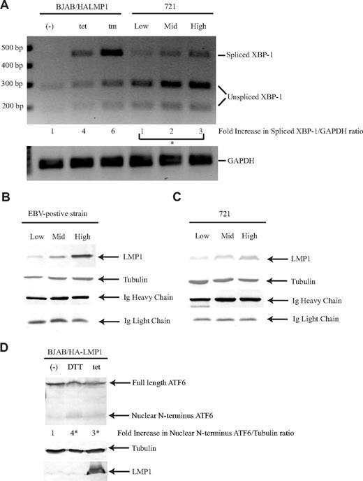 Figure 6. LMP1 induces all 3 pathways of the UPR. (A) BJAB/HA-LMP1 cells were untreated, treated with 10 ng/mL tetracycline for 48 hours, or treated with 2.5 μg/mL tunicamycin for 4 hours. The 721 cell line was sorted for low, medium, and high levels of LMP1. RNA was isolated from these cells and analyzed by RT-PCR using primers specific for both XBP-1 and GAPDH. To determine whether splicing of XBP-1 had occurred, the PCR fragments were digested with PstI. The ratios of spliced XBP-1 to GAPDH were calculated. The numbers represent the fold-difference relative to the ratio of untreated BJAB/HA-LMP1 cells, which was set at 1. *P (1-sided) <.05, 1-sided alternative: low, mid, high in increasing order, Jonckheere-Terpstra test. A gel representative of 3 independent experiments is shown. Production of Ig was measured by Western blotting the culture supernatant of EBV-positive strain cells (B) and 721 cells (C) that were sorted for low, medium, and high levels of LMP1 by staining with lysotracker red as described.60 For Ig heavy chain detection, 1 μL supernatant was analyzed, and for Ig light chain detection, 10 μL supernatant was analyzed, because the antibody preferentially detects Ig heavy chain. The cells were harvested and analyzed by Western blotting using antibodies to detect LMP1 and tubulin. A representative gel of duplicates of 2 independent experiments is shown. (D) BJAB/HALMP1 was electroporated with p3xFLAG-ATF6. Cells were either left untreated or treated with 10 mM DTT for 1.5 hours and 10 ng/mL tetracycline for 48 hours to induce LMP1. The cells were harvested and analyzed by Western blotting using antibodies to detect LMP1, tubulin, and Flag. The numbers represent the fold-difference of ratios of nuclear N-terminus ATF6 to tubulin. *P (2-sided) less than .05 (Wilcoxon rank sum test). A representative example of 3 independent experiments is shown.