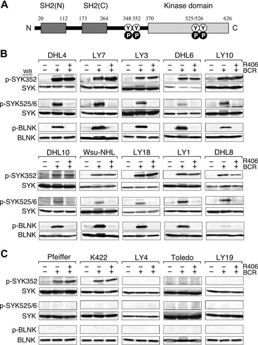 Figure 3. BCR signaling is intact in R406-sensitive DLBCL cell lines. (A) SYK domains and key tyrosine residues. The SYK tandem SH2 domains (black boxes), the linker region (aa 264-370), and the kinase domain (gray box) are shown. N indicates NH2-terminal; C, C-terminal; Y, tyrosine; P, phosphorylation. Following BCR engagement, LYN induces phosphorylation of SYKTyr348 and Tyr352 in the linker region. Thereafter, SYK undergoes autophosphorylation of SYKTyr525/526 and associated activation. (B-C) BCR signaling in R406-sensitive (B) and R406-resistant (C) DLBCL cell lines. The integrity of the BCR signaling pathway was assessed by crosslinking the B-cell receptor (+ BCR) and analyzing downstream events including the initial tyrosyl phosphorylation of SYK352, the subsequent autophosphorylation of SYK525/526 and the SYK-dependent phosphorylation of the B-cell linker protein (BLNK). In the same experiments, the specificity of R406 was assessed by incubating each of the DLBCL cell lines with the compound prior to BCR crosslinking (+ R406). Untreated cells or cells stimulated with anti-IgG/IgM in the presence or absence of R406 were then lysed and lysates size-fractionated, blotted, and analyzed with phospho-specific antibodies directed against SYK352 (top panel), SYK525/526 (middle panel), and BLNK (bottom panel). Thereafter, the blots were subsequently stripped and reprobed with anti-(total) SYK or anti-(total) BLNK antibodies as indicated.
