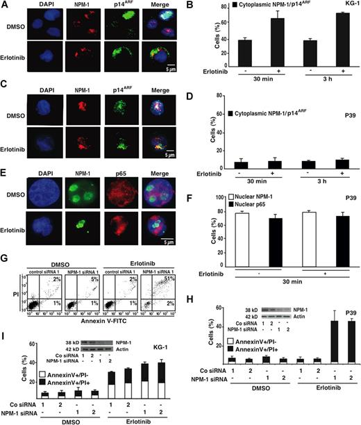 Figure 5. Influence of nucleophosmin-1 (NPM-1) on erlotinib-mediated cytolysis. (A) Typical immunofluorescence images obtained after staining of KG-1 cells with antibodies specific for NPM-1 and p14ARF. Chromatin was counterstained using DAPI. Note the nuclear localization of NPM-1 and p14ARF that is lost after erlotinib treatment (10 μM, 30 minutes) in favor of a cytoplasmic staining. (B) Quantitation of the data obtained as in panel A, 30 minutes or 3 hours after addition of erlotinib. (C-F) Failure of erlotinib to affect the subcellular localization of NPM-1 (C-F), p14ARF (C,D) and NF-κB p65 (E,F) in erlotinib-resistant P39 cells. Representative immunofluorescence microphotographs are shown in panels C and E, and quantitative results are reported in panels D and F. (G-I) Effect of NPM-1 knockdown on the apoptosis-inducing capacity of erlotinib in P39 and KG-1 cells. NPM-1 was knocked down with 2 distinct siRNA heteroduplexes (insets in panels H and I). Twenty-four hours after transfection erlotinib (or DMSO as a solvent control) was added for 48 hours, and the frequency of dying and dead cells was measured using the annexin V/PI method. Representative FACS pictograms are shown for P39 cells in panel G, and quantitative results (X ± SD, n = 3) are depicted for both P39 and KG-1 cells in panels H and I.