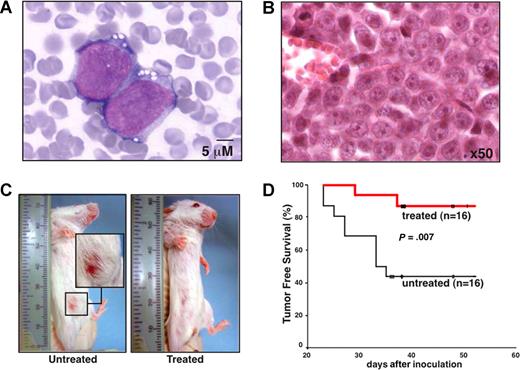 Figure 6. Therapeutic efficacy of erlotinib on human AML xenografts in SCID mice. (A,B) Cytologic and histopathologic features of KG-1 cells injected into SCID mice. Forty days after intraperitoneal inoculation of 106 KG-1 cells, ascites was subjected to Wright-Giemsa staining (A) and abdominal tumors were analyzed by HE staining (B) to demonstrate the presence of AML cells in the tissues. (C) Representative mice that were vehicle-only or erlotinib-treated with the presence or absence of abdominal tumor masses are shown. (D) Kaplan-Meier plot showing tumor-free survival. Mice were inoculated with KG-1 cells on day 0, and oral erlotinib administration was started on day 7 (5 days per week, 100 mg/kg per day). This experiment has been repeated once, yielding similar results.