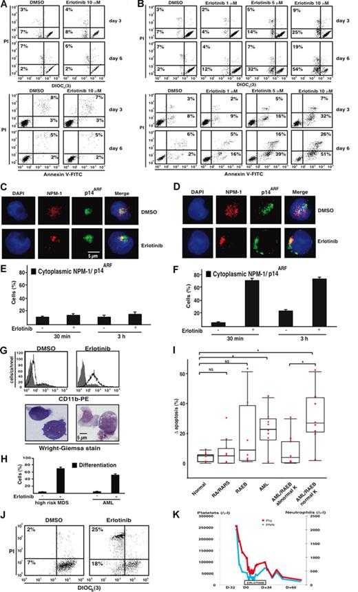Figure 7. Therapeutic effects of erlotinib ex vivo and in vivo. (A,B) Representative FACS diagrams of CD34+ bone marrow cells from a healthy volunteer and an AML patient with a normal karyotype. Cells were cultured with medium plus DMSO or erlotinib for 3 to 6 days, followed by the assessment of cell death with 2 distinct methods, the DiOC6(3)/PI and annexin V/PI staining of dying (DiOC6(3)low PI− or AnnV+PI−) and dead cells (PI+). Numbers in each quadrant are the percentages of total cells gated within the quadrant. (C-F) NPM-1 and p14ARF translocation induced by erlotinib in AML cells (D,F), but not in normal CD34+ bone marrow cells (C,E). Cells were treated and assessed as described in Figure 5A,D. Error bars represent SD. (G,H) Induction of myeloid differentiation by erlotinib in malignant myeloblasts. CD34+ bone marrow cells from a high-risk MDS (G,H) and an AML patient (H) were cultured for 6 days in the presence of 0.02% DMSO or 10 μM erlotinib. CD11b surface exposure was measured by FACS analysis while excluding apoptotic cells. (G) The morphology and percentage of cells exhibiting signs of erlotinib-induced differentiation were determined by Wright-Giemsa staining as described in Figure 3. (I) Quantitative comparison of apoptosis induction in a cohort of normal controls and different subgroups of MDS/AML patients. Results are depicted as a box plot, giving the increase in apoptosis induced by erlotinib (10 μM, 3 days) in vitro/ex vivo as compared with DMSO-only–treated controls in the indicated subgroups. K indicates karyotype; NS, not significant; *P < 0.01. The horizontal bar is the mean, the box the 25th percentile, and the whiskers the extremes. (J,K) Comparison of the ex vivo and in vivo effects of erlotinib on a patient with high-risk MDS. A patient diagnosed with metastatic EGFR-positive NSCLC and MDS RAEB-2 was treated with a monotherapy of erlotinib for the NSCLC. (J) Apoptosis-inducing effect of erlotinib on the patient's CD34+ bone marrow cells ex vivo (3 days, 10 μM) as assessed by staining with DiOC6(3)/PI. (K) Routine blood examinations before and during monotherapy with erlotinib demonstrated the in vivo effect of erlotinib on platelet and neutrophil counts resulting in a hematologic improvement. D-32 indicates day 32 before erlotinib treatment; D0, start of erlotinib therapy; D+34, day 34 under erlotinib treatment.