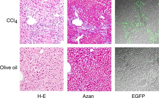 Figure 1. Microscopic features of livers after 12 weeks of CCl4 treatment. Mice that had received EGFP+ BM TNC transplants were treated with olive oil or CCl4 for 12 weeks, and livers of the mice were examined microscopically. Serial sections were stained with hematoxylin-eosin (H-E) and azan. Original magnification, ×100. Staining was analyzed using an Olympus BX50 light microscope equipped with a 10×/0.40 NA objective lens, an Olympus DP70 CCD camera, and DP Manager software, and images were processed using Adobe Photoshop CS. Simultaneous differential interference contrast and EGFP images were also acquired using an Olympus IX81 FV1000 laser scanning confocal microscope equipped with 20×/0.75 NA objective lens and using FV10-ASW software. Images were processed using Adobe Photoshop CS.