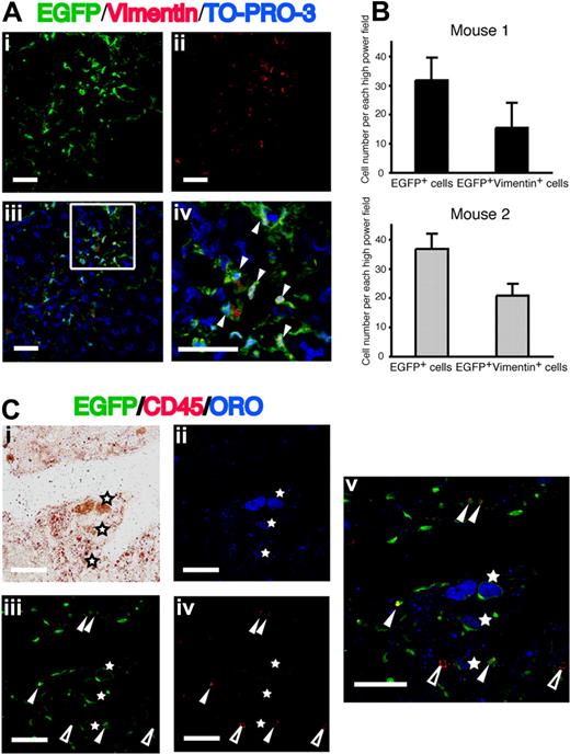 Figure 3. Expression of vimentin and ORO in EGFP+ cells in the fibrotic liver. (Ai) EGFP as green. (ii) Vimentin as red. (iii,iv) Merged images of EGFP, Alexa Fluor 568–labeled anti-vimentin, and TO-PRO-3. Nuclei were stained with TO-PRO-3. White triangles indicate cells expressing both EGFP and vimentin. Bars equal 30 μm. Images were acquired and processed as in Figure 2A. (B) The numbers of EGFP+ cells and EGFP+vimentin+ cells in the livers from 2 clonal cells–transplanted mice. Data are means plus or minus a standard deviations. (C) Liver sections were stained with ORO (red in panel i; blue in panel ii) and Alexa Fluor 568–labeled anti-CD45 (red in panel iv). (iii) EGFP as green. (v) A merged image of panels ii, iii, and iv. EGFP+ORO+ cells (white asterisks) are negative for CD45. White triangles and open triangles indicate EGFP+CD45+ cells and EGFP−CD45+ cells, respectively. Bars equal 30 μm. Images were acquired and processed as in Figure 2A.