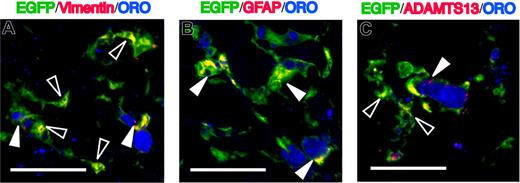 Figure 4. Characteristics of EGFP+ORO+ cells in the fibrotic liver. Sections were immunostained with anti-vimentin (A), anti-GFAP (B), or anti-ADAMTS13 (C), followed by Alexa Fluor 568–conjugated secondary antibody. EGFP+ORO+ cells are positive for vimentin, GFAP, and ADAMTS13. White triangles indicate cells coexpressing EGFP, ORO, and the respective markers. Open triangles indicate EGFP+ORO−vimentin+ cells (A) or EGFP+ORO−ADAMTS13+ cells (C). Bars equal 30 μm. Images were acquired using an Olympus IX81 FV1000 laser scanning confocal microscope equipped with 60×/1.42 NA oil-immersion objective lenses and using FV10-ASW software. Images were processed using Adobe Photoshop CS.