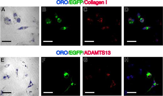 Figure 6. Characteristics of cultured nonparenchymal cells in the fibrotic liver. (A,E) Phase-contrast image merged with ORO (blue) of 3-day–cultured nonparenchymal cells, which were isolated from livers of mice that had received clonal cell transplants and were treated with CCl4. (B,F) EGFP as green. (C,G) Immunofluorescent images with collagen I (C) and ADAMTS13 (G). (D,H) Merged images of ORO, EGFP, and collagen I or ADAMTS13. EGFP+ORO+ cells are positive for collagen I and ADAMTS13. Bars equal 30 μm. Images were acquired and processed as in Figure 4.