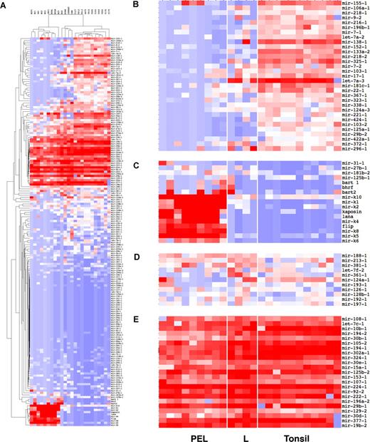 Figure 3. Pre-miRNA profile of PEL. (A) Unsupervised cluster analysis of standardized dCTU6 for pre-miRNAs using a correlation metric. Standardization was achieved by calculating Z scores across each individual array of dCTU6. This technique eliminates variation in assay performance between individual samples. Red indicates higher abundance; blue, lower than median abundance; white, the median. (B,C) Enlarged view. (B) Cluster of pre-miRNAs with decreased abundance in PEL vis-à-vis tonsil. (C) Cluster of pre-miRNAs with increased abundance in PEL vis-à-vis tonsil. (D) Cluster of pre-miRNAs equal abundance in PEL vis-à-vis tonsil. (E) Cluster of pre-miRNAs with high abundance in PEL as well as in nonvirus-associated lymphoma lines. The cluster of absent pre-miRNAs is not shown separately.