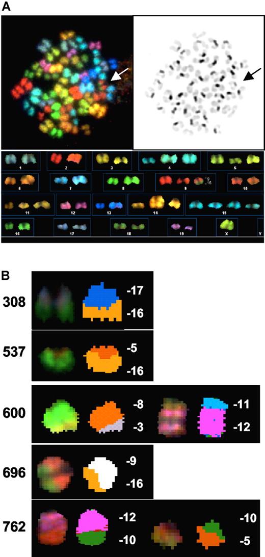 Figure 2. H2ax−/−p53−/−Rag2−/− thymic lymphomas harbor clonal translocations. (A) Shown is a spectral, DAPI, and karyotype image of a representative metaphase from H2ax−/−p53−/−Rag2−/− thymic lymphoma 696. (B) Shown are spectral images of the clonal translocations of H2ax−/−p53−/−Rag2−/− thymic lymphomas 308, 537, 600, 696, and 762.