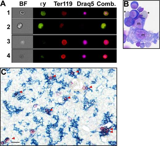 Figure 4. Primitive erythroblasts may associate with fetal liver macrophage cells in vivo. (A) ImageStream images of liver cells viewed in brightfield (BF) or stained with anti–ϵγ-globin (ϵγ) and Ter119 antibodies and Draq5. The right panel is a combination of images of the 3 fluorescent stains. ImageStream analysis software facilitates the identification of different erythroid populations in the liver by quantifying brightfield characteristics (contrast and gradient RMS, ie, irregular surface) as well as fluorescent stain intensities. Primitive orthochromatic erythroblasts (row 1) were contrasthi, gradient RMShi, ϵγ-globinhi, Ter119lo, large, Draq5+, small. Primitive enucleated erythrocytes (row 2) were contrasthi, gradient RMShi, ϵγ-globinhi, Ter119lo, large, Draq5−. Immature and mature definitive erythroblasts (rows 3 and 4, respectively) were distinguished from primitive erythroid cells by their nuclear size as well as by being contrastlo, gradient RMSlo, ϵγ-globinlo, and Ter119hi. (B) Cytospin preparations of E14.5 liver erythroblast islands stained with Wright-Giemsa reveal the presence of small numbers of primitive erythroid cells (*) attached to macrophage cells (m). (C) Immunohistochemistry of E15.5 liver reveals the very common spatial association (arrowheads) of ϵγ-globin–positive primitive erythroid cells (red) with F4/80-positive macrophage cells (blue). Scale bar = 20 μm.