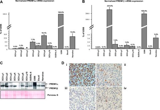 Figure 1. Low levels of PRDM1β expression in B lymphoma cell lines. (A,B) PRDM1α and PRDM1β mRNA in DLBCL cell lines (OCI-Ly1, OCI-Ly2, OCI-Ly3, OCI-Ly4, OCI-Ly7, OCI-Ly8, OCI-Ly18 and SUDHL-6) and Burkitt lymphoma cell lines (Daudi and Namalwa) were quantified by Taqman reverse-transcriptase-polymerase chain reaction, normalized with beta-glucuronidase, and expressed as a percentage relative to U266. For PRDM1α mRNA quantification: forward primer, TCCAGCACTGTGAGGTTTCA; reverse primer, TCAAACTCAGCCTCTGTCCA; probe, ATGGACATGGAGGATGCGGATATG. For PRDM1β mRNA quantification: forward primer, CCCGAACATGAAAAGACGAT; reverse primer, ATAGCGCATCCAGTTGCTTT; probe, TCCAGAGGGGAGCTTCACCACTTC. In OCI-Ly3, PRDM1α mRNA is not detectable by the primers shown above because of a chromosomal inversion breakpoint at intron 2 of the PRDM1 gene. Error bars indicate SE. (C) Western blotting of total protein extracts using the ROS monoclonal anti-PRDM1 antibody. The positions for PRDM1α and PRDM1β are indicated. Asterisk marks the nonspecific band. Ponceau S staining of the membrane is shown for protein loading control. (D) Examples of immunoperoxidase staining on paraffin tissue sections for PRDM1 in U266 cells (i) and representative DLBCL cases (ii-iv). U266 cells show uniform strong staining, while all or most of the tumor cells in DLBCL are negative for or weakly express PRDM1. A few scattered PRDM1+ cells serve as internal controls for the DLBCL cases. The DLBCL cases shown have the immunohistochemical profile of non-GCB-type DLBCL. Micrographs were acquired with a Nikon Microphot SA microscope (Nikon Instruments, Melville, NY) and a SPOT Insight Color Mosaic QE 4.2 camera and image acquisition software system (Diagnostic Instruments, Sterling Heights, MI).