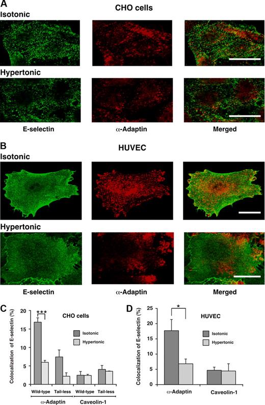 Figure 2. Cell-surface E-selectin colocalizes with α-adaptin, a component of clathrin-coated pits but not with caveolin-1, a component of caveolae. IL-1β-stimulated HUVECs or transfected CHO cells expressing wild-type or tail-less E-selectin were incubated in isotonic or hypertonic medium for 15 minutes, then fixed and incubated with biotinylated polyclonal antibodies to E-selectin, followed by streptavidin conjugated to Alexa 488. After permeabilization, the cells were incubated with a mAb to α-adaptin or caveolin-1, followed by donkey antimouse Ig conjugated to Cy-3. Using a confocal microscope, an optical section at several levels of each cell was examined for staining of E-selectin (green) or α-adaptin or caveolin-1 (red). Representative images of transfected CHO cells expressing wild-type E-selectin (A) or of IL-1β-stimulated HUVECs (B) revealed partial colocalization of E-selectin with α-adaptin in isotonic medium but significantly less colocalization in hypertonic medium. Bar represents 20 μm. (C,D) The degree of colocalization was quantified by measuring the percentage of green pixels (E-selectin) that colocalized with red pixels (α-adaptin or caveolin-1). The data represent the mean plus or minus SEM of at least 4 experiments, with at least 10 cells counted in each experiment (*P < .05; ***P < .001, as measured by the unpaired t test).
