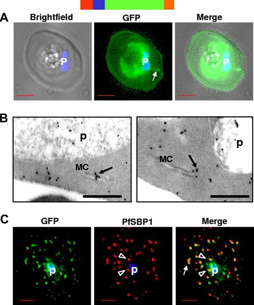 Figure 1. HTsol-GFP, a minimal soluble reporter exported to the erythrocyte cytoplasm and detected in clefts. (A) 0° projection of an erythrocyte infected with transgenic parasites expressing HTsol-GFP. Arrow indicates GFP-labeled intraerythrocytic structure, possibly a cleft. (B) Immunoelectron micrographs of trophozoite parasite (p)-infected cells expressing HTsol-GFP. Ultrathin sections were probed with antibodies to GFP and secondary antibody gold (10 nm) conjugate. Arrows indicate gold particles at intraerythrocytic Maurer's clefts (MC). No gold labeling was detected in absence of primary antibody or when a nonspecific primary was used (not shown). Bar, 200 nm. (C) Single optical section of an infected erythrocyte expressing HTsol-GFP. Samples were treated to release soluble GFP, fixed, and probed with antibodies to GFP (green) and P falciparum Skeletal Binding Protein1 (PfSBP1, red). Arrow, GFP labeled cleft structures at the periphery of infected erythrocyte; arrowheads, clefts proximal to the parasite. In fluorescence micrographs, p denotes parasite nucleus stained with Hoechst 33342; bar, 2 μm. Schematic representation of the construct is indicated above with ER-type signal sequence (red), sequence containing HT signal (blue) fused to GFP (green) and myc (orange).