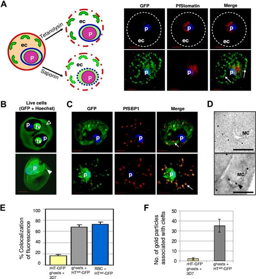 Figure 2. Lumenal association of HTsol-GFP at Maurer's clefts. (A) Schematic representation of the infected erythrocyte (left) and its permeabilization (dotted lines) after treatment with tetanolysin (top) or saponin (bottom). Panels of fluorescent images show infected erythrocyte expressing HTsol-GFP, permeabilized with tetanolysin (top) or saponin (bottom), and probed with antibodies to GFP (green) and PfStomatin (red). Respective merged images are also shown. Dotted lines indicate erythrocyte periphery. Arrows show intraerythrocytic clefts. (B) 0° projections of an rHT-GFP–loaded erythrocyte ghost infected with 3D7 P falciparum (top) or a mock-loaded erythrocyte ghost infected with transgenic parasite expressing HTsol-GFP (bottom). Empty arrowhead, cleft structure not labeled with intraerythrocytic rHT-GFP; solid arrowhead, GFP labeled cleft. (C) Cells in panel B fixed, permeabilized, and probed with antibodies to GFP (green) and resident cleft protein PfSBP1 (red). Arrows show clefts. (D) Immunoelectron microscopy of cells in panel B showing distribution of GFP associated with Maurer's clefts (MC). Bar indicates 500 nm. (E) Bar graph showing the percentage colocalization between GFP and Maurer's cleft in indicated samples by fluorescence microscopy. (F) Quantitation for the number of gold particles (measuring GFP) associated with clefts by immunoelectron microscopy over 20 infected erythrocytes. In all fluorescence micrographs: p, parasite (nucleus stained with Hoechst 33342; blue); ec, erythrocyte cytosol; bar, 2 μm.