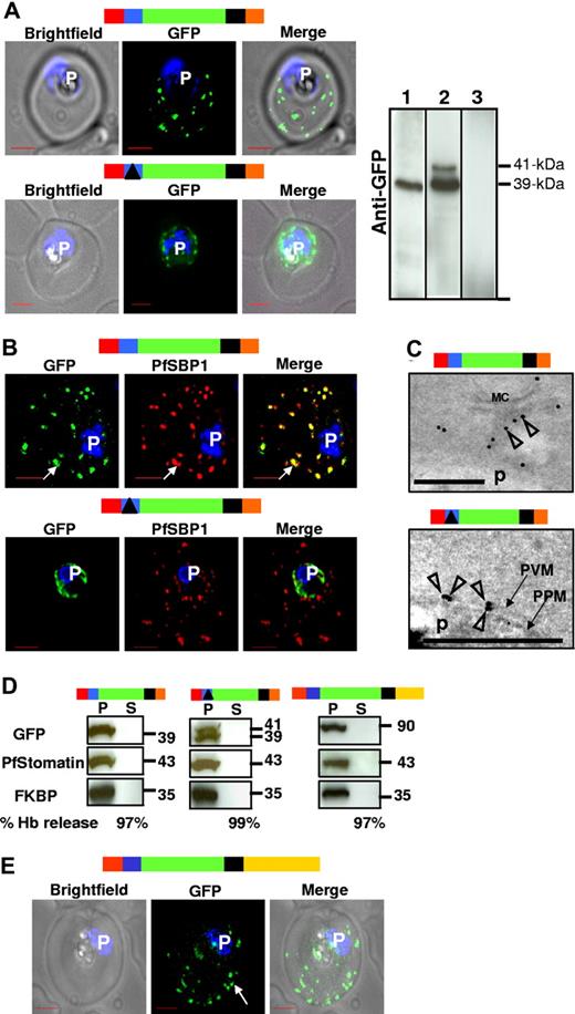 Figure 3. The HT motif targets proteins to Maurer's clefts without translocation into the erythrocyte cytoplasm. (A) Live infected erythrocytes expressing HT-GFPmembmyc (top) and Δ-GFPmembmyc (bottom) viewed under bright-field image, GFP fluorescence, and merged optics. Western blot using antibodies to GFP indicating the detection of 39-kDa fusion product for HT-GFPmembmyc-expressing cells (lane 1), 39/41-kDa doublet fusion product for Δ-GFPmembmyc-expressing cells (lane 2), or no signal for untransfected cells (lane 3) is shown at the right. In lane 2, the 41-kDa band is a precursor that in pulse chase experiments can be chased into the 39-kDa band (data not shown). Vertical lines have been inserted to indicate repositioned gel lanes. (B) Indirect immunofluorescence assay showing distribution of GFP (green), associated with HT-GFPmembmyc (top panel) or Δ-GFPmembmyc (bottom panel) relative to the Maurer's cleft protein PfSBP1 (red). Parasite nucleus (p) is stained with Hoechst 33342. (C) Localization of HT-GFPmembmyc in Maurer's clefts (MC, top) and Δ-GFPmembmyc in parasitophorous vacuolar membrane (PVM, bottom) by immunoelectron microscopy. Empty arrowheads indicate gold particles showing distribution of GFP chimeras. Bar, 500 nm; p, parasite. Micrograph at the bottom has been magnified twice compared with that at the top to distinguish the parasite plasma membrane (PPM) from the PVM. (D) Western blots of tetanolysin-released infected erythrocyte cytoplasm supernatant (S) and pellet (P) fractions of cells expressing HT-GFPmembmyc (left panel), Δ-GFPmembmyc (middle panel), and HT-GFPmembC-term (right panel) probed for GFP, PVM marker PfStomatin, and parasite cytoplasmic protein PfFKBP. Hemoglobin (Hb) released (in S) by tetanolysin is expressed as a percentage of the total Hb detected by hypotonic lysis. (E) Live infected erythrocytes expressing HT-GFPmembCterm viewed under bright-field image, GFP fluorescence, and merged optics. Schematic representation for all constructs are indicated above with ER-type signal sequence (red), sequence containing HT signal (blue) or its replacement (solid black triangle) fused to GFP (green), transmembrane region (black), and myc (orange). C-terminal region (derived from PfEMP1) is depicted in yellow.