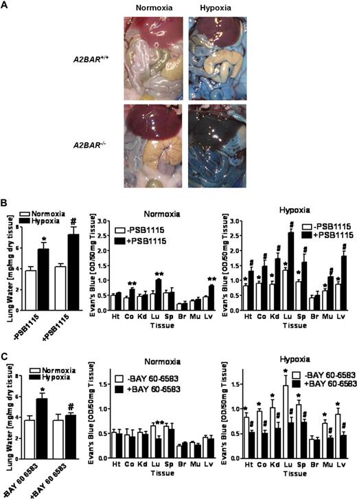 Figure 3. A2BAR and vascular permeability during hypoxia in vivo. (A) A2BAR−/− mice or age-, weight-, and sex-matched littermate controls were administered intravenous Evan blue dye (0.2 mL of 0.5% in PBS per mouse) and exposed to room temperature air or normobaric hypoxia (8% O2, 92% N2) for 4 hours. Representative images of abdominal dissections are shown. Images were obtained using a Canon Power Shot G9 digital camera (Canon, Krefeld, Germany). (B) Age-, weight-, and sex-matched wild type mice were administered a selective A2BAR antagonist (PSB1115, 20 mg/kg intraperitoneally) or an equal volume of PBS and lung water content was measured. In other experiments, mice were injected with intravenous Evan blue dye (0.2 mL of 0.5% in PBS per mouse) after PBS1115 or vehicle treatment and exposed to room air or to normobaric hypoxia (8% O2, 92% N2) for 4 hours. Animals were killed and the heart (Ht), colon (Co), kidney (Kd), lung (Lg), spleen (Sp), brain (Br), muscle (Mu) and liver were harvested. Organ Evan blue dye concentrations were quantified as described in “In vivo hypoxia model.” Data are expressed as means plus or minus SD of Evan blue OD/50 mg wet tissue; n = 6 animals/condition (*P < .05, compared with normoxia; **P < .05, compared with normoxic −PSB1115 controls; and #P < .05, compared with normoxia and −PSB115 controls). (C) Age-, weight-, and sex-matched wild type mice were administered a selective A2BAR agonist (BAY 60-6583, 80 μg/kg.) or an equal volume of PBS and lung water content was measured. In other experiments, mice were injected with intravenous Evan blue dye (0.2 mL of 0.5% in PBS per mouse) after BAY 60-6583 or vehicle treatment and exposed to room air or to normobaric hypoxia (8% O2, 92% N2) for 4 hours. Data are expressed as means plus or minus SD of Evans blue OD/50 mg wet tissue; n = 6 animals/condition (*P < .05, compared with normoxia; **P < .05, compared with −BAY 60-6583 normoxic controls and #P < .01, compared with −BAY 60-6583 hypoxic controls).