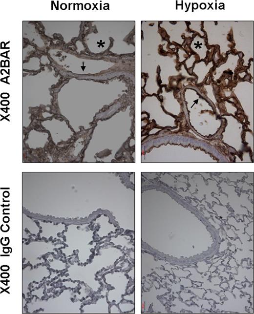 Figure 4. Pulmonary A2BAR expression increases after exposure to hypoxia in vivo. Wild-type mice were subjected to normoxia or 4 hours of ambient hypoxia (8% oxygen). Whole lungs were fixed with 10% formalin at total lung capacity. Lungs were stained with antibody for the A2BAR. Normal goat IgG was used in controls at identical concentration and staining conditions as the target primary Ab (arrow marks vascular, asterisk alveolar structures). Evaluation of the histologic and immunohistochemical stainings and photographic documentation was performed using an Olympus Vanox AH-3 light microscope (Hamburg, Germany), original magnification, ×400.