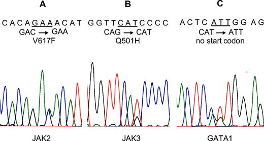Figure 1. Mutations of JAK2, JAK3, and GATA1 in a child with DS-AMKL. Mutations of JAK2 V617F (A), JAK3 Q501H (B), and GATA1 (2-3TG > AT, no start codon; C) were found in a child with DS-AMKL.