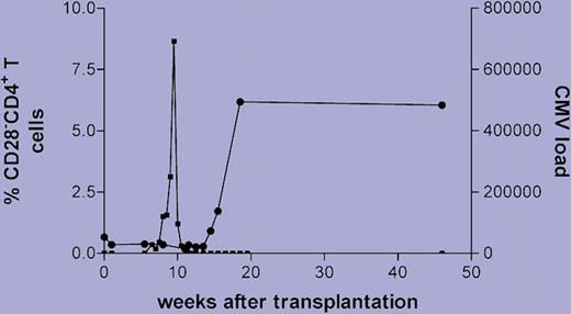 Longitudinal course of CD28−CD4+ T cells in relation to CMV viral load after transplantation of a kidney from a CMV-seropositive donor into a CMV-seronegative recipient. Squares indicate viral load; circles, percentage of CD28−CD4+ T cells in peripheral blood.