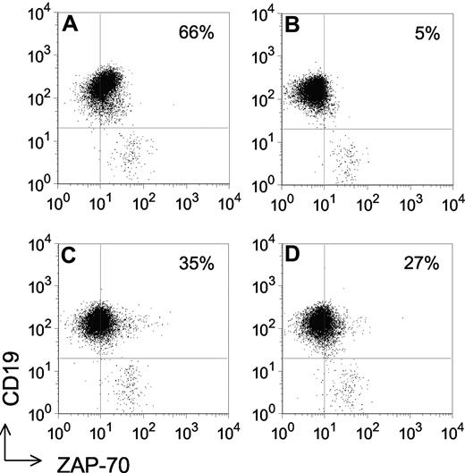 Figure 1. Detection of ZAP-70 in ZAP-70− CLL following transduction with Ad-ZAP-70 or Ad-ZAP-70-KA369. Dot plots depicting the log fluorescence of blood lymphocytes stained with Alexa-488–conjugated anti–ZAP-70 (x-axis) and PE-conjugated anti-CD19 (y-axis). The horizontal line depicts the threshold fluorescence exceeded by CD19+ CLL B cells, whereas the vertical line indicates the threshold fluorescence exceeded by cells scored as ZAP-70+, using a defined gating strategy, as described.11 The number provided in the top right-hand corner of each panel provides the percentage of the CD19+ CLL B cells with fluorescence exceeding the ZAP-70 threshold. CLL cell samples that have more than 20% ZAP-70+ cells are scored as being ZAP-70+. (A) ZAP-70+ CLL cell sample. (B) a ZAP-70− CLL cell sample transduced with a control adenovirus vector. (C) The same CLL sample as in panel B transduced with Ad-ZAP-70. (D) The same CLL sample as in panel B transduced with Ad-ZAP-70-KA369.
