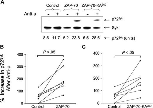 Figure 2. Increases in phosphorylated p72Syk induced by anti-μ in ZAP-70− CLL transduced with Ad-ZAP-70 or Ad-ZAP-70-KA369. (A) Comparison of CBA assay with immunoblot analysis to detect phosphorylated p72Syk. Phosphorylated p72Syk was determined by immunoblot analysis and CBA assay for ZAP-70− CLL transduced with Ad-ZAP-70 or Ad-ZAP-70-KA369. The band intensity for the anti-μ–stimulated CLL samples transfected with wild-type ZAP-70 was similar to that noted for the anti-μ–stimulated samples transfected with ZAP-70-KA369, providing a ratio of signal intensity that was similar to that using the CBA assay. The immunoblot results are a representative one of 3 experiments. (B,C) Percentage increase in phosphorylated p72Syk induced by treatment with anti-μ, as indicated on the y-axis of each panel. Each symbol represents the percentage increase in phosphorylated protein detected in an individual CLL cell sample. The lines connect the percentage increase in detected phosphorylated protein of anti-μ–treated CLL cell samples transduced with Ad-lacZ (“Control” in each panel) versus that measured in the same CLL cells that had been transduced with Ad-ZAP-70 (B) or Ad-ZAP-70-KA369 (C). The mean anti-μ–induced increase in each phosphoprotein detected in the Ad-ZAP-70– or Ad-ZAP-70-KA369–transduced CLL cells was significantly greater than that noted for the same phosphoprotein in the Ad-lacZ–transduced CLL cells following treatment with anti-μ (P < .05), which was not significantly different from that of anti-μ–treated mock-transfected CLL cells.