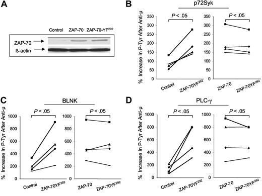 Figure 5. Transduction of ZAP-70− CLL cells with Ad-ZAP-70 versus Ad-ZAP-70-YF292 and measurement of anti-μ–induced increases in phosphorylated p72Syk, BLNK, or PLC-γ. (A) Immunoblot ana-lysis for ZAP-70 (top row) in lysates of CLL cells before or after transduction with Ad-ZAP-70 or Ad-ZAP-70-YF,292 as indicated at the top of each lane. The blots were stripped and then reprobed with anti–β-actin to monitor for protein loading (bottom row), as indicated on the left of each blot. (B-D) Anti-μ–induced percentage increases in phosphorylated p72Syk (B), BLNK (C), or PLC-γ (D) detected in ZAP-70− CLL B cells that were transduced with the control vector or Ad-ZAP-70-YF292 (left panel) or with Ad-ZAP-70 or Ad-ZAP-70-YF292 (right panel). Each symbol represents the percentage increase in phosphorylated protein detected in an individual CLL cell sample. The lines connect the percentage increase in detected phosphorylated protein of anti-μ–treated CLL cells of the same sample transduced with each of the different vectors. The differences in the mean percentage increase of phosphorylated protein upon anti-μ treatment in control vector–transduced CLL cells versus that of Ad-ZAP-70-YF292–transduced CLL cells was significant (P < .05). However, there was not a significant difference in the mean percentage increase of phosphorylated protein upon anti-μ treatment of Ad-ZAP-70–transduced CLL cells versus that of Ad-ZAP-70-YF292–transduced CLL cells.