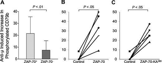 Figure 7. Anti-μ–induced increases in phosphorylated CD79b in ZAP-70+ versus ZAP-70− CLL cells or ZAP-70− CLL B cells made to express ZAP-70-Wt or ZAP-70-KA369. (A) Each bar represents the mean percentage increase in phosphorylated CD79b observed following treatment with anti-μ of CLL B cells that were ZAP-70+ (N = 28) or ZAP-70− (N = 19), as indicated at the bottom of the figure. The error bars indicate the standard deviation of the mean. The difference in the mean percentage increase in ZAP-70+ CLL cells versus ZAP-70− CLL cells was significant, as indicated by the P value at the top of the figure. (B,C) Anti-μ–induced increases in the level of phosphorylated CD79b detected in ZAP-70− CLL cells transduced with a control adenovirus or Ad-ZAP-70 (B), or control adenovirus or Ad-ZAP-70-KA369 (C). The lines connect the percentage increase in detected phosphorylated CD79b of anti-μ–treated CLL cell samples transduced with Ad-lacZ (“Control” in each panel) versus that measured in the same CLL cells that had been transduced with Ad-ZAP-70 (B) or Ad-ZAP-70-KA369 (C).