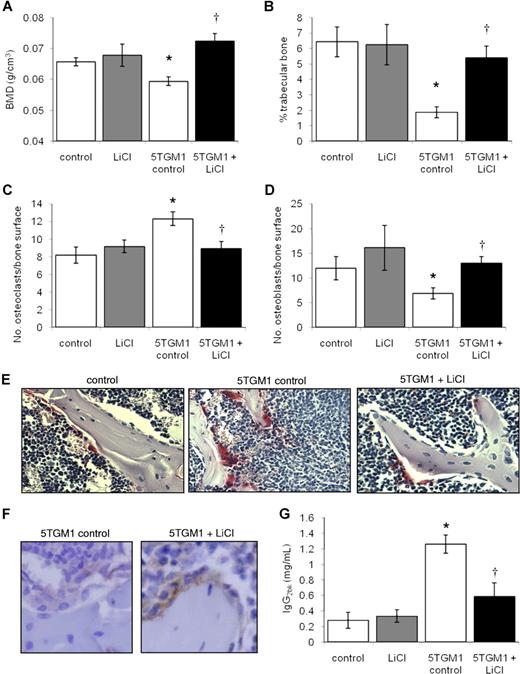 Figure 1. LiCl inhibits the development of myeloma bone disease in vivo. Bone mineral density is significantly increased in 5TGM1 myeloma–bearing mice following treatment with LiCl (A). Histomorphometric analysis demonstrated an increase in trabecular bone volume (B), a decrease in osteoclast number (C), and an increase in osteoblast number (D) in 5TGM1 myeloma–bearing mice following treatment with LiCl. Histologic sections of tibiae from non–tumor-bearing mice, 5TGM1 myeloma–bearing mice, and 5TGM1 myeloma–bearing mice treated with LiCl demonstrated increased osteoclasts lining the trabecular bone surface in 5TGM1 myeloma–bearing mice, and a reduction in osteoclast number in myeloma-bearing mice treated with LiCl. Osteoclasts were identified by TRAP staining. Original magnification, ×200. (E). Immunohistochemistry demonstrated an increase in β-catenin expression in osteoblasts lining the bone surface in myeloma-bearing mice treated with LiCl compared with control. Original magnification, ×400 (F). Treatment with LiCl significantly reduced serum IgG2bκ concentrations in 5TGM1 myeloma–bearing mice (G). Data are expressed as means (± SEM). *P < .05 compared with nontumor control. †P < .05 compared with 5TGM1 control.