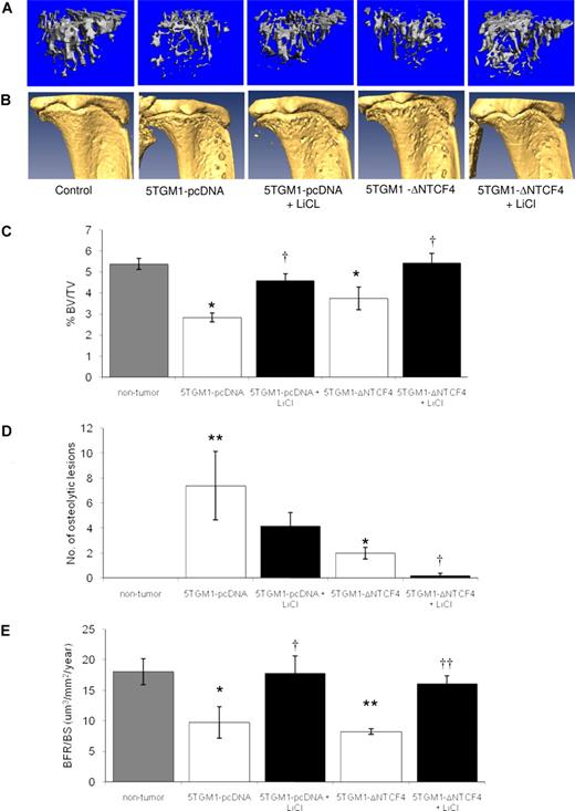 Figure 6. Increasing Wnt signaling in the bone microenvironment prevents the development of myeloma bone disease. MicroCT analysis of tibiae of 5TGM1-pcDNA and 5TGM1-ΔNTCF4 myeloma–bearing mice demonstrated a significant reduction in trabecular bone volume (A,C) and increase in osteolytic bone lesions (B,D) that was prevented by treatment with LiCl. LiCl also significantly prevented the reduction in bone formation rates associated with the development of myeloma bone disease (E). Data are expressed as means (± SEM). *P < .05 compared with nontumor. **P < .01 compared with nontumor. †P < .05, ††P < .01 compared with untreated.