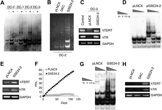 Figure 6. GSE24-2 reactivates telomerase in X-linked dyskeratosis congenita and VA13 cells. (A) Telomerase activity in X-linked dyskeratosis congenita patient lymphoblast cells obtained from a carrier mother (DC-C) and her affected children (DC-1, DC-2, and DC-3). Cells were transiently transfected with 3 μg of the empty vector (−) or GSE24-2 (+) per million cells. Telomerase activity was measured 24 hours later. (B) DC2 cells were transiently transfected with 3 μg pLNCX-, GSE24-2–, or DKC-expressing vectors, per million cells. Telomerase activity was measured 24 hours later. (C) Expression levels of hTERT and hTR in cells from one of the patients (DC-3) transfected with 3 μg of the empty vector or GSE2-2 per million cells. RNA levels were detected by RT-PCR. GAPDH was used as a control. (D) GMO1787 X-DC patient-derived fibroblasts were infected with pLNCX- or GSE24-2–derived viruses and stable cell lines were used to determine telomerase activity (total protein amount indicated in triangles). (E) Expression levels of hTERT and hTR in GMO1787 transfected with the pLNCX of pGSE24-2 plasmids were determined by RT-PCR. GAPDH was used as a control. (F) Growth rates of the GMO1787-transfected cells described in panel D are compared by cumulative PDLs with time. All the experiments were repeated 3 times, with similar results. (G) Telomerase activity in VA13 cells. Cells were transiently transfected with 16 μg pLNCX control vector or GSE24-2 per million cells. Telomerase activity was measured 24 hours later, using serial dilutions of protein extracts (total protein amount indicated in triangles). (H) Expression levels of hTERT and hTR in VA13 cells transfected with 16 μg pLNCX, DKC, or GSE24-2 plasmid per per million cells. RNA levels were determined by RT-PCR. GAPDH was used as a control.
