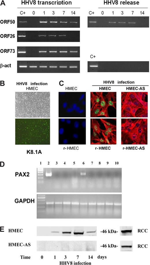 Figure 1. HHV-8–induced acute infection and PAX2 expression in HMECs. (A) Subconfluent HMEC monolayers were infected with HHV-8 and analyzed at different productively infected times for virus transcription and release. RT-PCR amplification was performed for the indicated HHV-8 genes using RNA extracted from infected cells. β-actin levels were determined in the same samples as control. Positive controls of amplification of the genes analyzed (C+) are shown. Virus release was evaluated in the culture supernatant by PCR amplification of HHV-8 ORF50 gene. β-actin gene was also amplified to verify the absence of cellular contaminating DNA. (B) Representative micrographs of the same microscopic field observed by phase contrast and by immunofluorescence showing that approximately 20% of the cells stained for the viral HHV-8 antigen ORF K8.1A. Micrographs were obtained by Zeiss Axioskop (Jena, Germany) using 20× objective. (C) Representative confocal micrographs costaining of PAX2 (green) and the viral HHV-8 antigen ORF K8.1A (red) in control uninfected dermal HMECs and renal-HMECs (r-HMECs) and, in HHV-8–infected HMECs, r-HMECs, HMEC-AS, and r-HMEC-AS. Uninfected HMECs and r-HMECs did not express PAX2, but 3 days after infection they showed nuclear staining for PAX2. HHV-8 infection failed to induce PAX2 expression in HMEC-AS and r-HMEC-AS (Zeiss LSM 5 Pascal confocal laser scanning microscope equipped with a helium/neon 543 mm laser, an argon 450 to 530 mm laser, and an EC planar NEOFluar 40×/1.3 oil DIC objective lens; acquisition software, Zeiss LSMS, version 3.2). (D) Representative RT-PCR showing the expression of PAX2 mRNA in cells derived from renal carcinoma used as positive control (lane 2), in HMECs infected with HHV-8 after 8 hours (lane 3), 16 hours (lane 4), 24 hours (lane 5), and 3 days (lane 6) and in HMEC-AS infected with HHV-8 after 8 hours (lane 7), 16 hours (lane 8), 24 hours (lane 9), and 3 days (lane 10). (E) Representative Western blot analysis of PAX2 protein expression by HMECs and HMEC-AS after 8 hours, 1, 3, 7, and 14 days after HHV-8 infection showing a band corresponding to 46 kDa. As positive control, lysates of cells derived from renal carcinoma (RCC) were used. Three individual experiments were performed with similar results.