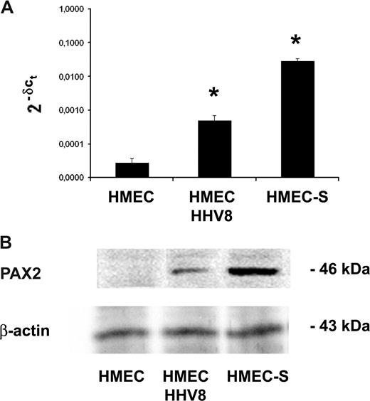 Figure 2. Comparison of PAX2 protein and mRNA expression in HMEC-S and in HMEC/HHV-8. (A) PAX2 mRNA expression analyzed by quantitative real-time PCR was performed for using RNA extracted from HMEC-S stably transfected with sense vector of PAX2 and HMECs infected with HHV-8. The normalized expression of PAX2 gene with respect to beta2 microglobulin was computed for all samples. Values are fold changes with respect to control and are the mean plus or minus SD of 2 independent experiments performed in triplicate. Mann-Whitney nonparametric test was performed (* P < .05, HMEC-S and HMECs/HHV-8 vs control HMECs). (B) Representative Western blot analysis of PAX2 protein expression by control HMECs, HMEC-S, and HMECs 3 days after HHV-8 infection showing a band corresponding to 46 kDa.