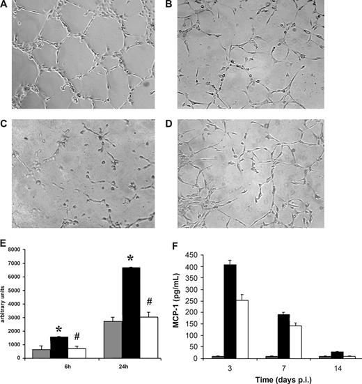 Figure 3. HHV-8 induced in vitro neoangiogenesis and MCP-1 production in HMECs but not in HMEC-AS. The ability of endothelial cells to form capillary-like structures within Matrigel was evaluated. Uninfected and HHV-8-infected HMECs and HMEC-AS (5 × 104) harvested 3 days after infection were seeded on growth factor–reduced Matrigel in RPMI plus 1% FCS, and the extent of capillary-like structure formation was observed after 6 and 24 hours. (A-D) Representative micrographs showing the network of capillary-like structures formed by HMECs (A) and HMEC-AS (B) infected with HHV-8, by HMECs coincubated with blocking MCP-1 antibody (C), and uninfected HMECs (D) after 24 hours of incubation. (E) Morphometric evaluation of ring-like structures formed within Matrigel (gray columns, uninfected HMEC; black columns, infected HMEC; white columns, infected HMEC-AS). Data are mean plus or minus SD of 3 independent experiments performed in triplicate detected by Nikon Eclipse TE 200 inverted microscope (objectives, 10×/0.25; Tokyo, Japan), analyzed by the Micro-image system (Casti Imaging), and expressed as arbitrary units by the computer analysis system at ×100 magnifications. Analysis of variance with Newman-Keuls multiple comparison test was performed (*P < .05, infected HMECs vs uninfected HMEC; #P < .05, infected HMEC-AS vs infected HMECs). (F) HMECs or HMEC-AS were infected with HHV-8. At the indicated productively infected times, culture supernatant was analyzed for the release of the MCP-1 by standard quantitative ELISA assays. Levels of chemokines are total pg/mL. Columns represent the same variables as listed for panel E. Bars represent the mean plus or minus SD of triplicate samples. Control is represented by supernatant of uninfected HMECs.