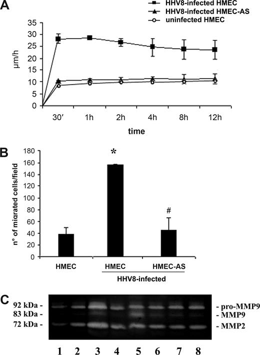 Figure 5. HHV-8 induced in vitro endothelial cells motility and invasion correlated with the expression of PAX2. (A) The motility of uninfected HMECs (o), HHV-8–infected HMECs (■) and HHV-8-infected HMEC-AS (▲) was monitored by time-lapse analysis and measured in μm/h as described in “Cell motility.” Results are mean plus or minus SD of 3 individual experiments. ANOVA with Dunnett multiple comparison test was performed (*P < .05, infected HMECs, infected HMEC-AS, and uninfected HMECs). (B) The invasion of Matrigel-coated filters by uninfected HMECs or HMECs and HMEC-AS infected with HHV-8 was evaluated. Cells were seeded onto Matrigel precoated upper well (100 μg/well) and incubated for 48 hours at 37°C, 5% CO2, in a humidified atmosphere. The lower wells were loaded with medium plus 10% FCS. Cells that migrated to the underside of the filters were fixed with methanol, stained with Giemsa solution, and counted in 5 microscopic fields in each well. Data are mean plus or minus SD of 3 independent experiments performed in triplicate. ANOVA with Newman-Keuls multiple comparison test was performed (*P < .05, infected HMECs vs uninfected HMEC; #P < .05, infected HMEC-AS vs infected HMECs). (C) Representative zymographic analysis of uninfected HMECs (lane 2), HMECs (lane 3), and HMEC-AS (lane 4) 3 days after infection with HHV-8; HMECs (lane 5) and HMEC-AS (lane 6) 7 days after infection with HHV-8; HMECs (lane 7) and HMEC-AS (lane 8) 14 days after infection with HHV-8. Lane 1 shows the control RPMI supplemented with 10% FCS (lane 1). Three experiments were performed with similar results.