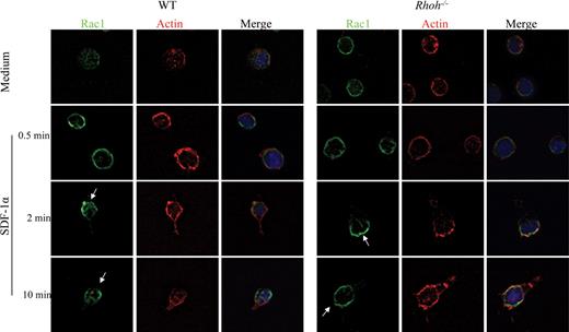 Figure 4. Subcellular localization of endogenous Rac1. Lin−/c-kit+ cells were stimulated with SDF-1α (100 ng/mL) for indicated times, fixed, and then stained with anti-Rac1 mAb (green), rhodamine-labeled phalloidin (red), and 4′,6-diamidino-2-phenylindole (blue). The leading edges are indicated with a white arrow. The representative images from 3 independent experiments are shown.