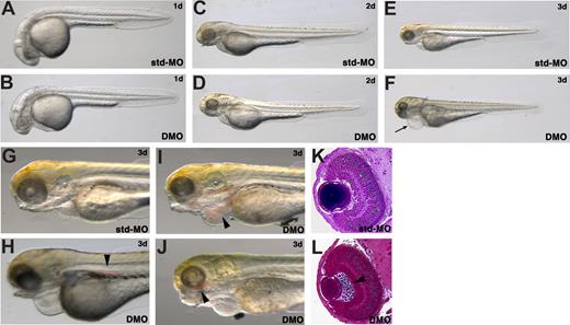 Figure 3. The double knockdown of sox7 and sox18 does not cause gross morphologic abnormalities but selectively affects trunk/tail blood circulation. Control embryos (A,C,E) were injected with a dose of std-MO (0.5 pmol) corresponding to the total dose of MOs injected in the double morphants. Low doses of sox7-MO1 and sox18-MO1 (0.25 pmol) were not causing gross morphologic defects when injected separately (Figure S3) or coinjected (DMO) (B,D,F). More than 90% of the double morphants showed no sign of trunk/tail blood circulation, while minor circulatory defects were detectable in single morphants (Table S1). (A,B) Control embryo and double morphant at 1 dpf. Images were taken at 32× magnification, anterior to the left. (C,D) control embryo and double morphant at 2 dpf. Images were taken at 25× magnification, anterior to the left. (E,F) control larva and double morphant at 3 dpf. Images were taken at 20× magnification, anterior to the left. By this stage, heart edema is clearly detectable in the double morphants (black arrow). (G-J) Images at 50× magnification of a control larva injected with std-MO (G), and 3 double morphants showing blood accumulation (black arrowheads) in the anterior trunk (H), in the heart to yolk region (I) where residual circulation is detectable, and in the eye region (J). Anterior to the left. (K,L) 132× magnification images of cross-sections at the level of the eye showing a control std-MO–injected embryo and a double morphant at 2 dpf. The black arrowhead points to blood accumulation in the inner optic circle in the double morphant. Anterior to the top.