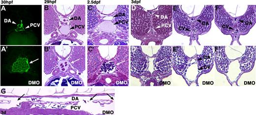 Figure 6. The double knockdown of sox18 and sox7 results in multiple AV shunts. We analyzed sections from control embryos and double morphants from 29-30 hpf to 3 dpf, using both the fli1:EGFP line and a wild-type background. Multiple AV shunts between the DA and the axial vein are visible in the trunk/tail region of the double morphants. (A,A′) fluorescent images of cross sections of a control std-MO–injected embryo (A) and a double morphant (A′) at 30 hpf, in the tg(fli1:EGFP)y1 line. Two distinct vessels, corresponding to the DA and the PCV (arrowheads), surrounded by fluorescent endothelial cells, are visible in the control, whereas a single, enlarged vessel full of presumptive blood cells is present in the double morphant's section (arrow). (B,B′) Cross sections of a control std-MO–injected embryo (B) and a double morphant (B′) at 29 hpf, showing an AV fusion. (C,C′) cross sections of a control std-MO–injected embryo (C) and a double morphant (C′) at 2.5 dpf, showing an AV fusion with putative blood clot. (D,D′-F,F′) a rostro-caudal series of cross sections, before (D,D′) or after the anus (E,E′,F,F′) showing control std-MO–injected embryos (D-F) and a double morphant (D′-F′) at 3 dpf. The axial artery and vein are fused in panels D′ and F′, but not in E′ (ie, multiple fusions occur along the axial vessels, as documented also in panel G). (G) longitudinal section of a 3-dpf double morphant, anterior to the left. A separation is visible, in the central part of the panel, between the DA and the PCV (the notochord is clearly visible above the DA, and the gut below the PCV), but multiple AV shunts are detectable (arrows), allowing blood cells to freely move from one vessel to the other.