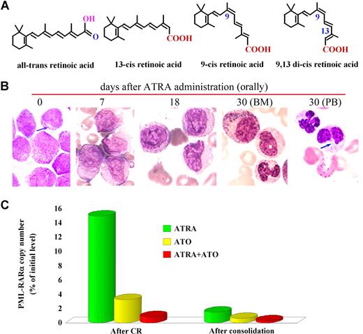 Figure 2. ATRA in treating APL. (A) Isomers of retinoic acid. (B) ATRA induces terminal differentiation of abnormal promyelocytes in vivo. On day 30 of treatment, Auer bodies (arrow) are found in neutrophils circulating in the peripheral blood, indicating these cells are derived from leukemic promyelocytes. (C) ATRA treatment leads to elimination of PML-RARα–positive cells revealed by detection of minimal residual disease (MRD) using quantitative real-time RT-PCR for assessment of PML-RARα transcript. Effects of ATO and ATRA in combination with ATO are also shown. Stains were analyzed using an Olympus BX51 research microscope equipped with a 100×/1.3 NA oil objective, and images were processed using Adobe Photoshop CS.