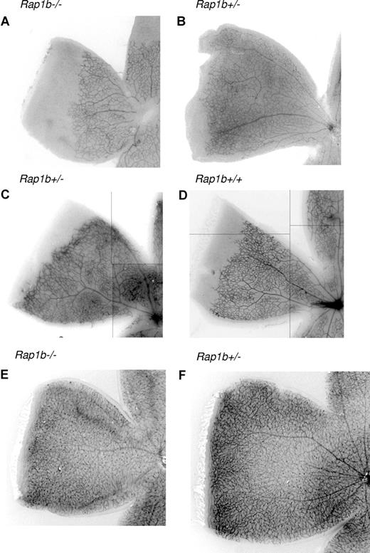 Figure 2. Delayed neonatal vascularization in P7 Rap1b−/− retinas. Retinas from P7 littermate Rap1b−/− (A) and Rap1b+/− pups (B); littermate Rap1b+/− (C) and Rap1b+/+ (D) pups; and P14 littermate Rap1b−/− (E) and Rap1b+/− pups (F) were isolated, fixed, mounted, and stained with fluorescent isolectin, as described in “Analysis of retinal neovascularization.” Shown is a representative image of a quarter of each retina. Decrease in vascularization of P7 Rap1b−/− retinas is absent at the P14 stage. Lines have been inserted to indicate composite images.