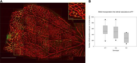 Figure 4. Decreased BrdU incorporation into endothelial cells in Rap1b−/−retinas. (A) Low-magnification image (left micrograph) is a composite of confocal images comprising a quarter of the retina isolated from a P7 Rap1b+/− mouse, which had been injected intraperitoneally with BrdU and stained with Texas red–conjugated isolectin (endothelium, red) and FITC-conjugated anti-BrdU antibody (nuclei, green). Bar represents 500 μm. Boxed area is enlarged (insert) to better show the detail of nuclear staining by BrdU. Bar represents 50 μm. Lines have been inserted to indicate sections of the composite image. (B) Quantification of all BrdU-positive nuclei in one quarter of a retina from each analyzed pup. Plotted are data from Rap1b+/+ (WT), Rap1b+/− (Het), and Rap1b−/− (KO) mice. For each dataset, the box shows 25th to 75th percentile range and median. Whiskers extend to the 10th and 90th percentile, and standard error of the mean is plotted. The number of dividing endothelial cells was significantly reduced in Rap1b−/− versus normal retinas (284 ± 75 vs 543 ± 101; n = 6; P < .05).