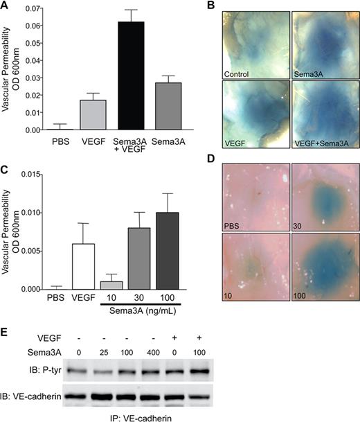 Figure 2. Sema3A potentiates VEGF-induced permeability and induces VP on its own. (A) Sema3A potentiation of VEGF-mediated VP was determined by subcutaneous injection of PBS, VEGF (40 μg/mL),17 Sema3A (30 μg/mL), or VEGF with Sema3A in Balb/c mice. Evans blue dye (1.5%) extravasation was quantitated (n = 8). Data represent means plus or minus SEM. (B) Representative images of Sema3A- and/or VEGF-induced permeability. (C) Sema3A dose-dependently induces VP as shown by injecting mice with increasing amounts of Sema3A (μg/mL), VEGF, or PBS as control (n = 6). Evans blue dye (1%) extravasation was quantitated. Data represent mean plus or minus SEM. This experiment was repeated twice with similar results. (D) Representative images of dose-dependent Sema3A-induced permeability. (E) Sema3A dose-dependently induces tyrosine phosphorylation of VE-cadherin as demonstrated by treatment of HUVECs with increasing amounts of Sema3A (ng/mL), VEGF (50 ng/mL), or both. This experiment was repeated multiple times with similar results.