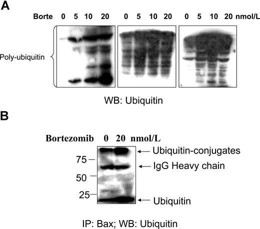 Figure 6. Bortezomib-induced polyubiquitination and Bax–ubiquitin conjugation. Fresh CLL cells were treated with bortezomib for 16 hours. (A) Polyubiquitination. CLL cells from 3 different patients were lysed with the lysis buffer. A total of 50 μg proteins was loaded into each lane. The antiubiquitin antibody was used at 1:500 dilution. Multiple ladders in the blot show an accumulation of polyubiquitinated proteins. (B) CLL cells were lysed with Chaps containing lysis buffer. A total of 500 μg protein was used for immunoprecipitation (IP) with Bax 6A7 antibody overnight at 4°C, and Bax–ubiquitin conjugation was probed with the antiubiquitin antibody at 1:500 dilution. The numbers on the left side of the blot are molecular weights of standard proteins. WB indicates Western blotting.