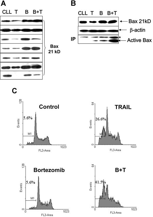 Figure 7. Proteasome inhibitor facilitates TRAIL-induced Bax activation and apoptosis. Fresh CLL cells were pretreated with 10 nM/L bortezomib for 1 hour and then incubated with or without 500 ng/mL TRAIL for 16 hours. (A) TRAIL ± bortezomib induced changes of Bax protein levels in 7 cases of CLL patients. (B) Association between Bax protein levels and Bax conformational change. CLL indicates the control; T, TRAIL-treated; B, bortezomib-treated; B + T, treated with bortezomib and TRAIL. The anti-Bax antibody 2D2 was used for Western blotting. The active Bax proteins were immunoprecipitated (IP) with 1 μg anti-Bax 6A7 antibody and detected by Western blotting using anti-Bax 2D2 antibody at 1:1000 dilution. (C) Apoptotic cell death was measured by DNA content assay. This is 1 of 3 separate experiments. Numbers shown in the flow cytometry profiles are percentages of apoptotic cells (sub-G0/G1 population).