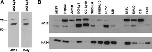 Figure 2. Investigation of FOXP1 isoform expression using Western blotting. (A) Western blotting of the OCI-Ly3 ABC-like DLBCL cell line with the JC12 monoclonal antibody or an anti-FOXP1 polyclonal antibody demonstrates the predominance of smaller isoforms. (B) Western blotting of a panel of cell lines using the JC12 antibody demonstrating high-level expression of the smaller isoforms in the OCI-Ly3, OCI-Ly10, and HLY-1 DLBCL cell lines.