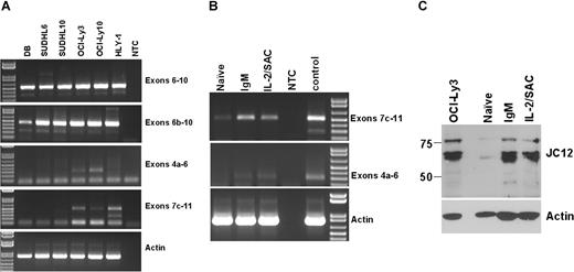 Figure 6. Analysis of FOXP1 isoforms in DLBCL cell lines and nonmalignant B cells. (A) RT-PCR detection of FOXP1 isoforms in DLBCL cell lines. NTC indicates no template control. Actin was included as a control for cDNA quality. (B) RT-PCR detection of FOXP1 isoforms 9 and 3 in naive and activated (IgM, IL-2/SAC) peripheral blood B cells. (C) Western blotting detection of FOXP1 expression in the OCI-Ly3 cell line as a positive control and in naive and activated (IgM, IL-2/SAC) peripheral blood B cells using the JC12 monoclonal antibody. Blots were reprobed with antiactin as a loading control.