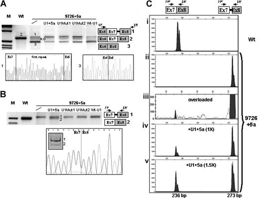 Figure 2. Rescue of FVII splicing by modified U1-snRNAs in Hep3B cells. (A,B) Electrophoretic separation on 3% agarose gel, and direct sequencing, of RT-PCR products obtained from total RNA of cells transfected with the expression vectors for normal (Wt) or mutated (9726 + 5a) minigenes, and equimolar concentrations of plasmids encoding for the modified U1-snRNAs. The separation on 12% polyacrylamide gel of the amplified transcripts on U1 + 5a expression and the sequence of the correctly spliced form are also shown in the lower part of panel B. The scheme of transcripts (1, 2, 3) and the primers used (arrows) are depicted on the right side. The additional band observed for the 9726 + 5a mutant (A) corresponded to heteroduplex (H.D), as demonstrated by sequencing. Fragment sizes in panel A were: 637 bp (1), 600 bp (2), and 480 bp (3). Fragment sizes in panel B were: 228 bp (1) and 191 bp (2). M indicates molecular weight marker. (C) Separation on a denaturing capillary system (automated ABI-3100) of fluorescently labeled RT-PCR products obtained from total RNA of cells expressing the Wt (i) or the 9726 + 5a minigene without (ii,iii) and on (iv,v) overexpression of the U1 + 5a snRNA. The scheme of transcripts, and of primers used (arrows), is depicted on the top. Separation of 1 μL of 1:100 diluted RT-PCR reaction is shown, with the exception of panel Ciii) in which 1 μL of the 1:20 dilution was loaded (overloaded). The peaks, which might suggest the presence of a doublet, were referred to as single bands by the automated ABI-3100 system. As expected, the fragment sizes of the normal and aberrant transcripts were 236 bp and 273 bp, respectively.