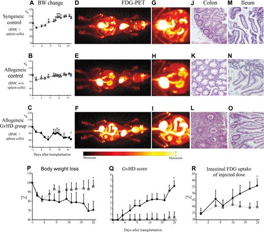 Figure 1. Intestinal GVHD in mice after allogeneic HSCT was associated with increased local FDG uptake mainly localized to the colon. Lethally irradiated CB6F1 mice received 2.0 × 107 BMCs alone (allogeneic control; □) or together with 1.0 × 107 splenocytes (allogeneic GvHD group; ●) from parental BALB/c donors. In the syngeneic control group, CB6F1 recipients were given transplanted of grafts from CB6F1 mice containing 2.0 × 107 BMCs and 1.0 × 107 splenocytes (◇). Body weight loss was used as a measure of GVHD in recipient mice after syngeneic (A) or allogeneic (B,C,P) HSCT. In vivo imaging after application of 10 MBq FDG with a small-animal PET scanner 21 days after transplantation (D-I) demonstrated a marked increase of FDG uptake in the colons of animals with GVHD (F,I) compared with physiologic FDG uptake in the gut of both control groups (panels D,G and E,H). Histopathology of the colon revealed GVHD with tissue infiltration by lymphocytes and mucosa cell apoptosis in the GVHD group (L) and no evidence of GVHD in control animals (J,K). In the small intestine of recipient mice with or without GVHD, only low levels of FDG uptake were observed. Histopathologic analyses of the small intestine showed normal mucosa in all groups (M-O). In an independent set of experiments, intensity and progression of GVHD were correlated with FDG-PET results. GVHD severity was monitored using a clinical score (Q), as detailed in “Methods,” and by body weight loss (P). At each time point, 4 to 6 transplant recipients per group were examined in vivo by PET scan 1 hour after application of 10 MBq FDG. FDG uptake associated with gastrointestinal inflammation was quantified by calculation of FDG uptake in the gut as percentage of the dose injected (R). The results are representative of at least 3 independent experiments. Original magnification for histopathology was 100-fold. Error bars indicate positive standard deviations for each time point. *Statistically significant differences versus both control groups (P < .05).