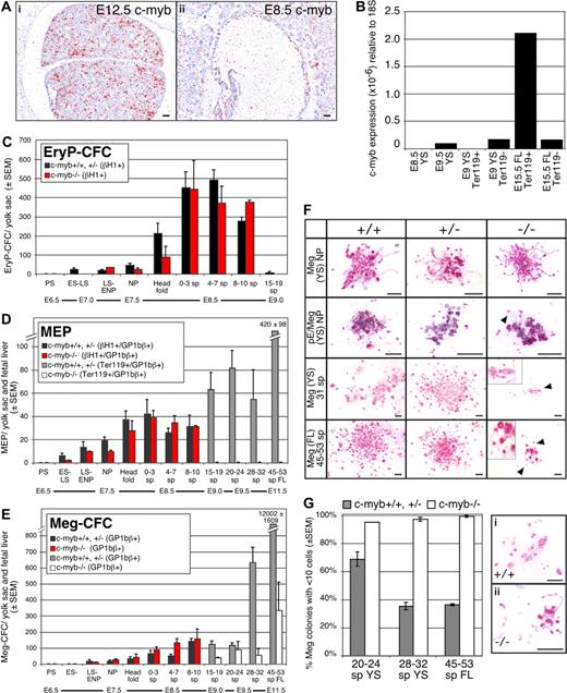 Figure 1. Emergence of the erythroid and megakaryocyte lineages in wildtype and c-myb–null mouse fetuses. (A) Expression of c-myb in E12.5 (i) and E8.5 (ii) mouse embryos analyzed by in situ hybridization. c-myb transcripts accumulated in E12.5 fetal liver but were not detected above background in E8.5 yolk sac blood islands. Size bars indicate 50 μm. (B) Quantitation by qPCR of c-myb transcripts in sites of hematopoiesis and in purified erythroid cell populations: (1) E8.5 yolk sac (YS), (2) E9.5 yolk sac, (3) Ter119-positive cells from E9.0 yolk sac (16-20 sp), (4) Ter119− cells from E9.0 yolk sac (16-20 sp), (5) Ter119+ cells from E15.5 fetal liver (FL), and (6) Ter119− cells from E15.5 fetal liver. (C-E) Early ontogeny of primitive erythroid progenitors (EryP-CFC), bipotential megakaryocyte/erythroid progenitors (MEP), and megakaryocyte progenitors (Meg-CFC) between E6.5 and E11.5 of gestation in c-myb–null (−/−) and combined wildtype (+/+) and c-myb-heterozygous (+/−) mouse embryos. Mean (± SEM) of each progenitor type is graphed. Wildtype and c-myb-heterozygous embryos revealed similar progenitor numbers and temporal kinetics. EryP-CFC-derived colonies contain βH1-globin+ primitive erythroid cells, MEP-derived colonies contain GP1Bβ+megakaryocytes and either primitive erythroid (βH1-globin+ cells through 19 sp) or definitive erythroid (Ter119+ cells > 19 sp), and Meg-CFC-derived colonies contain GP1Bβ+ megakaryocytes. Embryonic stages and (number of embryos examined at each stage): PS, primitive-streak (2); ES-LS, early primitive streak to late primitive streak (9); NP, neural plate (21); head fold, (16) and number of somite pairs; 0 to 3 sp (16); 4 to 7 sp (21); 8 to 10 sp (5); 15 to 19 sp (12); 20 to 24 sp (18); 28 to 32 sp, (15) 45 to 59 sp. (9). (F) Morphology of Meg-CFC-derived colonies (Meg) and primitive MEP-derived colonies (pE/Meg) from wildtype (+/+), c-myb-heterozygous (+/−), and c-myb–null (−/−) embryos. Megakaryocytes (red/pink stain) are labeled with rat anti–mouse GP1bβ (Emfret Analytics, Würzburg, Germany), and primitive erythroid cells (blue/purple stain) are labeled with rabbit anti–mouse βH1-globin16 as described in Tober et al.4 All cultures were grown for 10 days. Arrows and higher magnification insets highlight proplatelet formation. Size bars indicate 50 μm. (G) Mean percentage (± SEM) of Meg-CFC-derived colonies (composed of GP1bβ-positive cells) consisting of fewer than 10 megakaryocytes in combined wild-type (+/+) and c-myb–heterozygous (+/−; ) and c-myb–null (−/−, ▭) mouse embryos. Representative small colonies from wild-type (i) and c-myb–null (ii) E10.5 cultures are shown. Proplatelet formation and platelet-sized fragments are evident. Size bars indicate 50 μm. Images were processed with lens defect correction and brightness/contrast optimization in Photoshop (Adobe, San Jose, CA) with Fovea Pro plug-in (Reindeer Graphics, Ashville, NC).