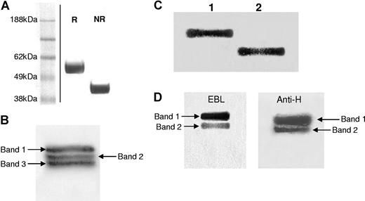 Figure 3. Trypsin digestion of VWF. (A) Twelve percent SDS-PAGE analysis of the major fraction obtained by ion-exchange chromatography of trypsin-digested VWF under reducing (R) and nonreducing (NR) conditions followed by Coomassie staining. (Vertical line indicates a repositioned gel lane.) (B,C) Of the purified 55-kDa fragment, 20 nM was partially digested with PNGase F for 2 hours at 37°C (B) and completely digested with PNGase F overnight at 37°C (C), and analyzed in 12% SDS-PAGE gels followed by Western blotting to nitrocellulose membranes and probing with anti–VWF-HRP. (D) Partially PNGase F–digested VWF 55-kDa fragment was also detected with elderberry bark lectin (EBL) specific for terminal sialic acid residues (left panel) and Ulex europaeus specific for the H-antigen (right panel).