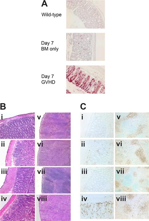 Figure 4. Host IDO induction and IDO-mediated spleen and colon protection do not require donor Tregs. (A) IHC for IDO in colon 7 days after transplantation with Balb/c TCD BM with or without 2 × 106 CD4+CD25− T cells. (B) Hematoxylin and eosin staining of colon (i-iv) and spleen (v-viii) 7 days after transplantation with Balb/c TCD BM with or without 2 × 106 CD4+CD25− T cells. (i,v) Wild-type BM only. (ii,vi) Wild-type GVHD. (iii,vii) IDO−/− BM only. (iv,viii) IDO−/− GVHD. (C) Tissues from panel B stained for CD4 by IHC. Original magnification ×200 for colons, ×100 for spleens.